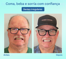 ⏰Prótese Dentária Premium Tiworld® 🍀Próteses Funcionais AdaptableFit (Somente HOJE!)🔥