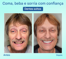⏰Prótese Dentária Premium Tiworld® 🍀Próteses Funcionais AdaptableFit (Somente HOJE!)🔥