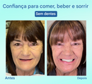 ⏰Prótese Dentária Premium Tiworld® 🍀Próteses Funcionais AdaptableFit (Somente HOJE!)🔥