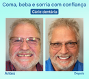 ⏰Prótese Dentária Premium Tiworld® 🍀Próteses Funcionais AdaptableFit (Somente HOJE!)🔥