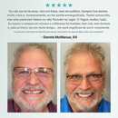 🦷 Prótese Dentária Completa Médica Yagoo™ com Forte Sucção (Somente HOJE!)🔥