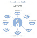 Facetas dentárias / prótese de encaixe (snap on denture): uma mudança que transforma sua vida instantaneamente. (Somente HOJE!)🔥